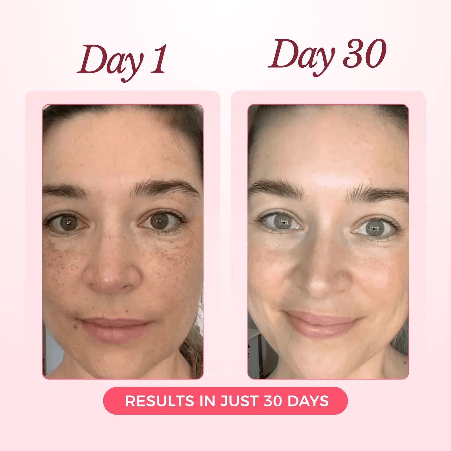 Glow Up 2.0 – מסכת קולגן יוקרתית עם תוצאות ברמת ספא