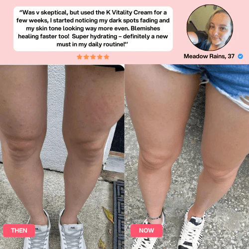 K-Vitality Cream™